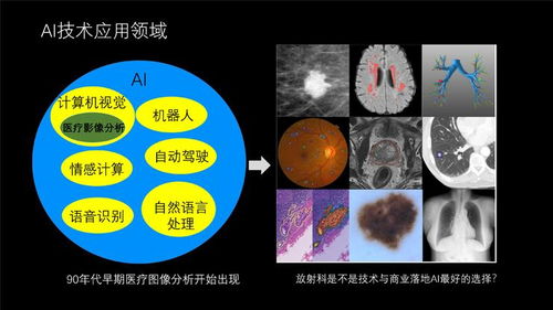数坤科技刘建 医院会为怎样的影像AI产品买单 丨公开课回顾